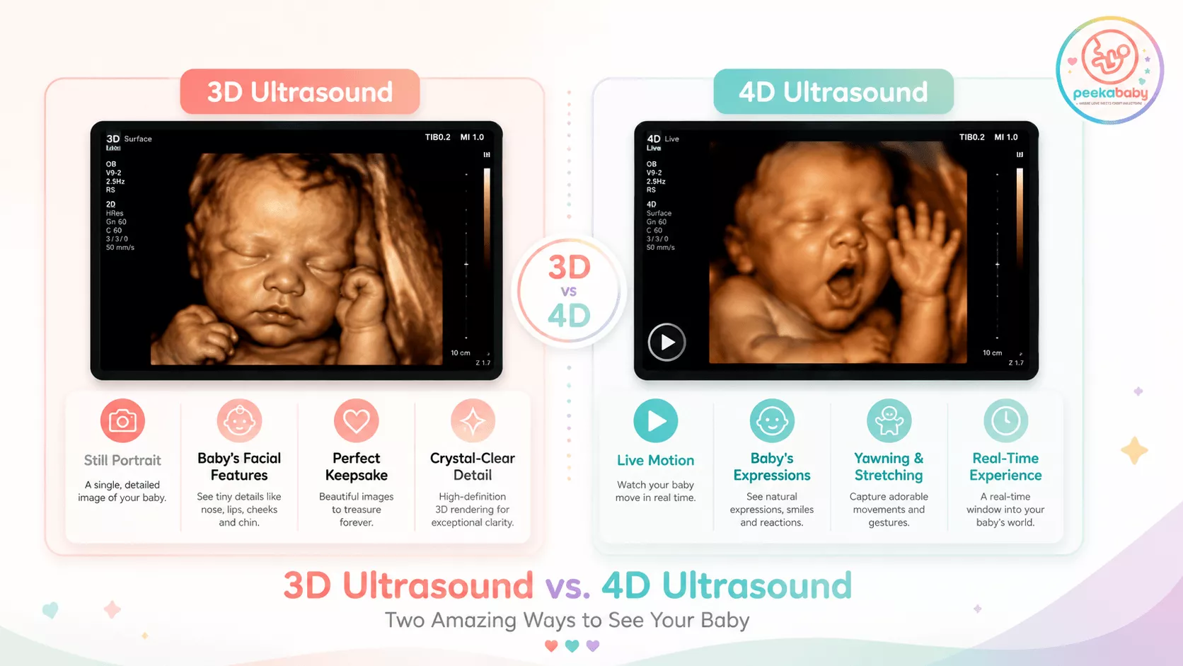 3D Ultrasound vs. 4D Ultrasound: What's the Difference?