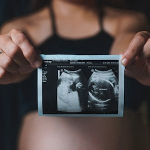 Pregnant woman holding ultrasound scan print