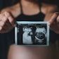 2D baby scan print