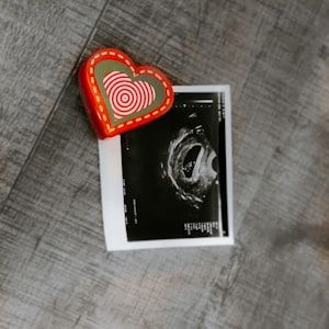 Baby's ultrasound scan print with a heart keepsake