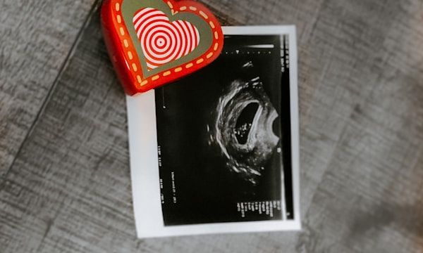 Baby scan print with heart keepsake decoration