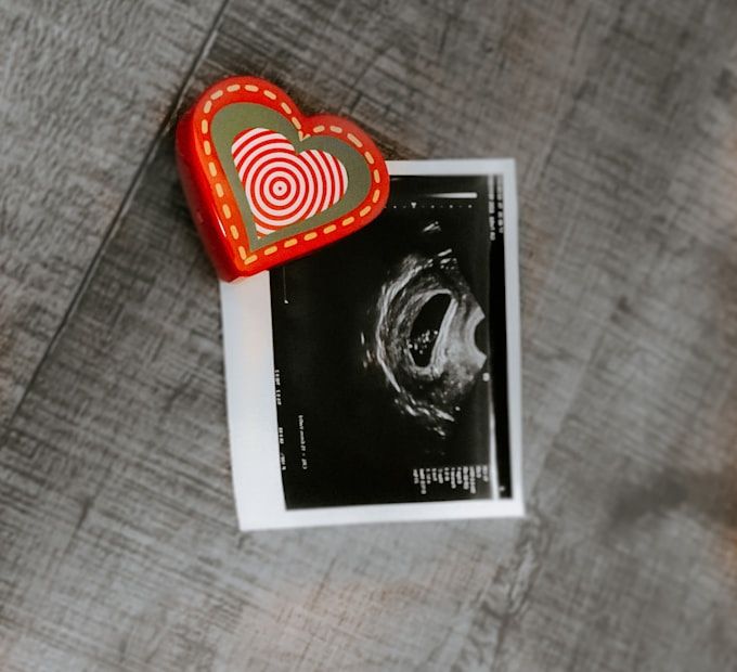 Baby's first ultrasound scan print · 12 weeks