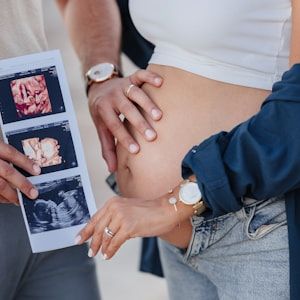 Couple admiring their baby's 3D scan