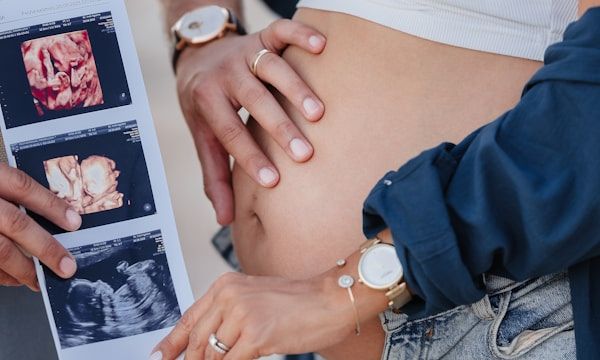 Couple viewing their baby's 3D ultrasound portrait