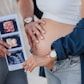 Couple with 3D ultrasound portrait
