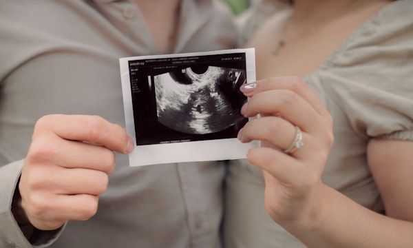 Gender reveal scan couple celebrating