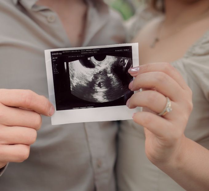 Couple holds their baby's scan outdoors · 27 weeks