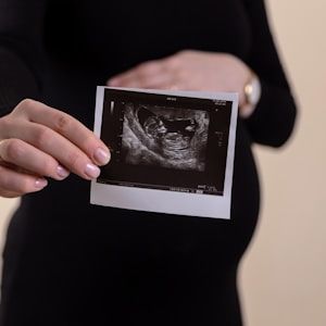 Expectant mother holding her baby's scan