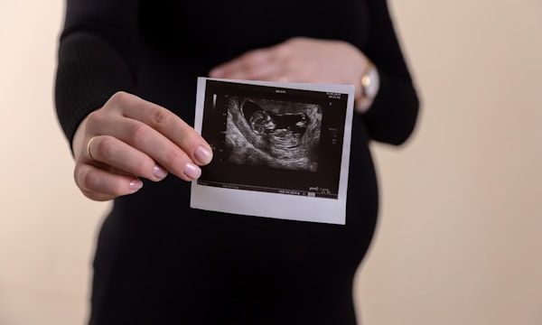 Expectant mother holding her early pregnancy scan