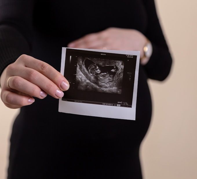 Expectant mother holding 3D baby ultrasound scan print at PeekABaby, Scarborough, Toronto
