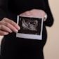Expectant mother with early pregnancy scan