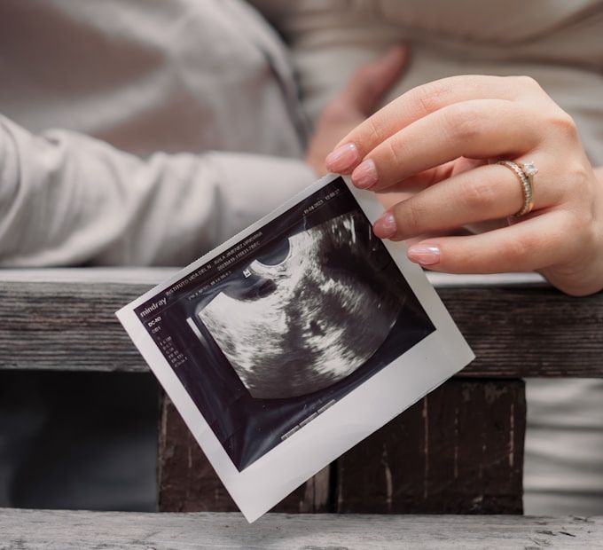 Holding baby's ultrasound scan photo