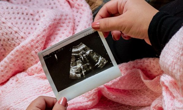 3D ultrasound portrait of baby's face