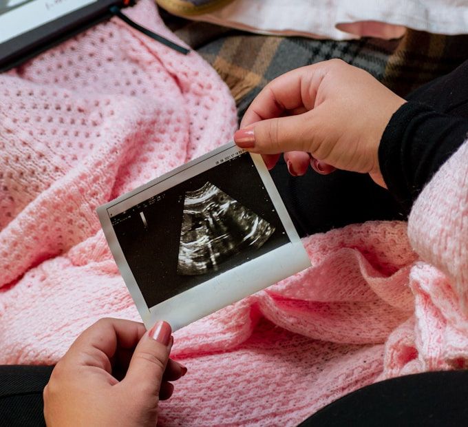 Mum holds her baby's first scan print · 28 weeks