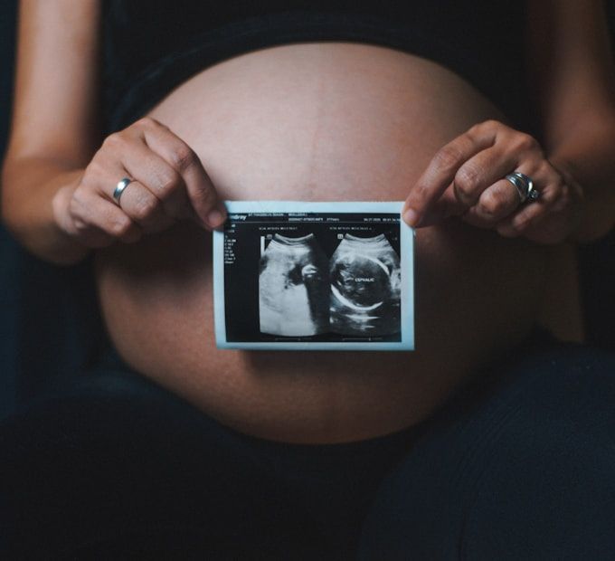 Early pregnancy reassurance scan