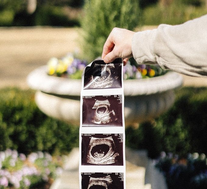 Strip of ultrasound scan prints held up in the garden