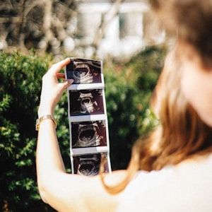 Strip of baby ultrasound scans held up outdoors